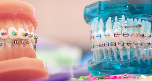 Orthodontic options
