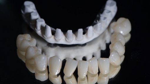 biocompatible PEEK in dentistry