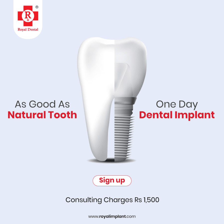 dental implant