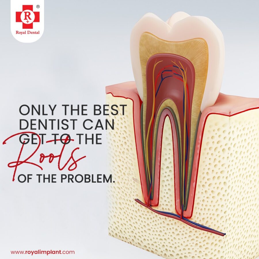 toothache-Hyperaemia