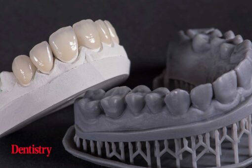 3D printing in dental