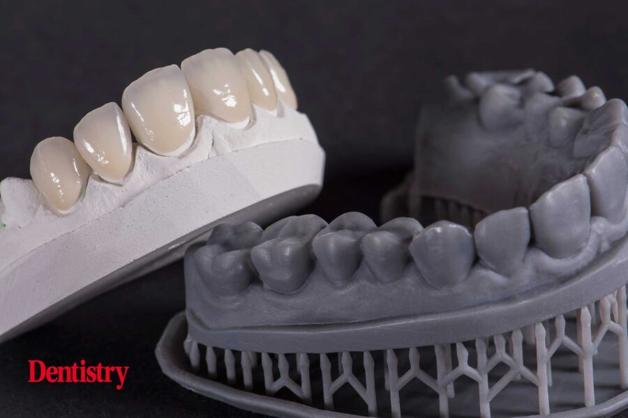 3D printing in dental