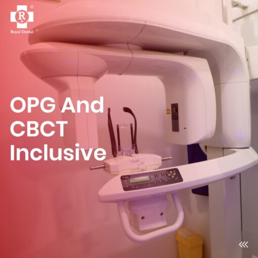 In-house CBCT X-ray