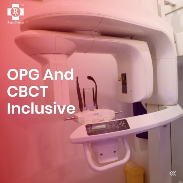 In-house CBCT X-ray