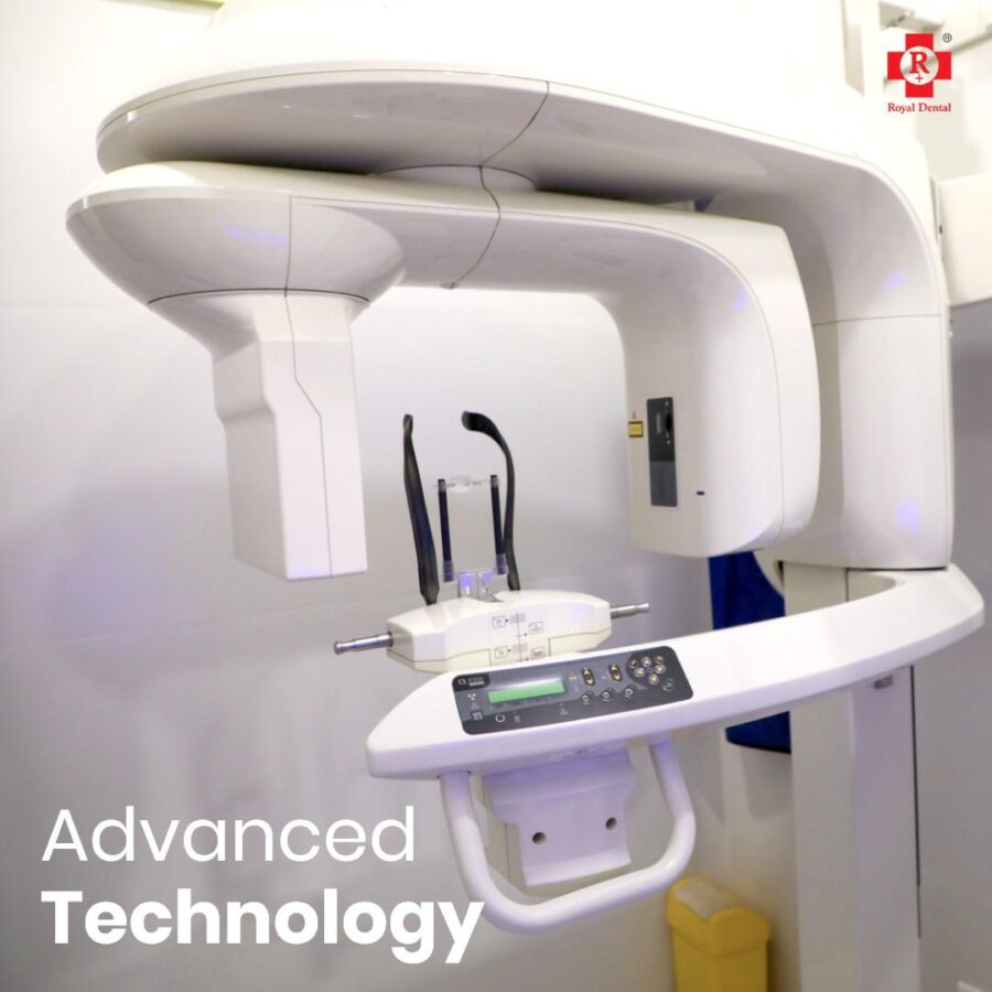 CBCT opg x-rays