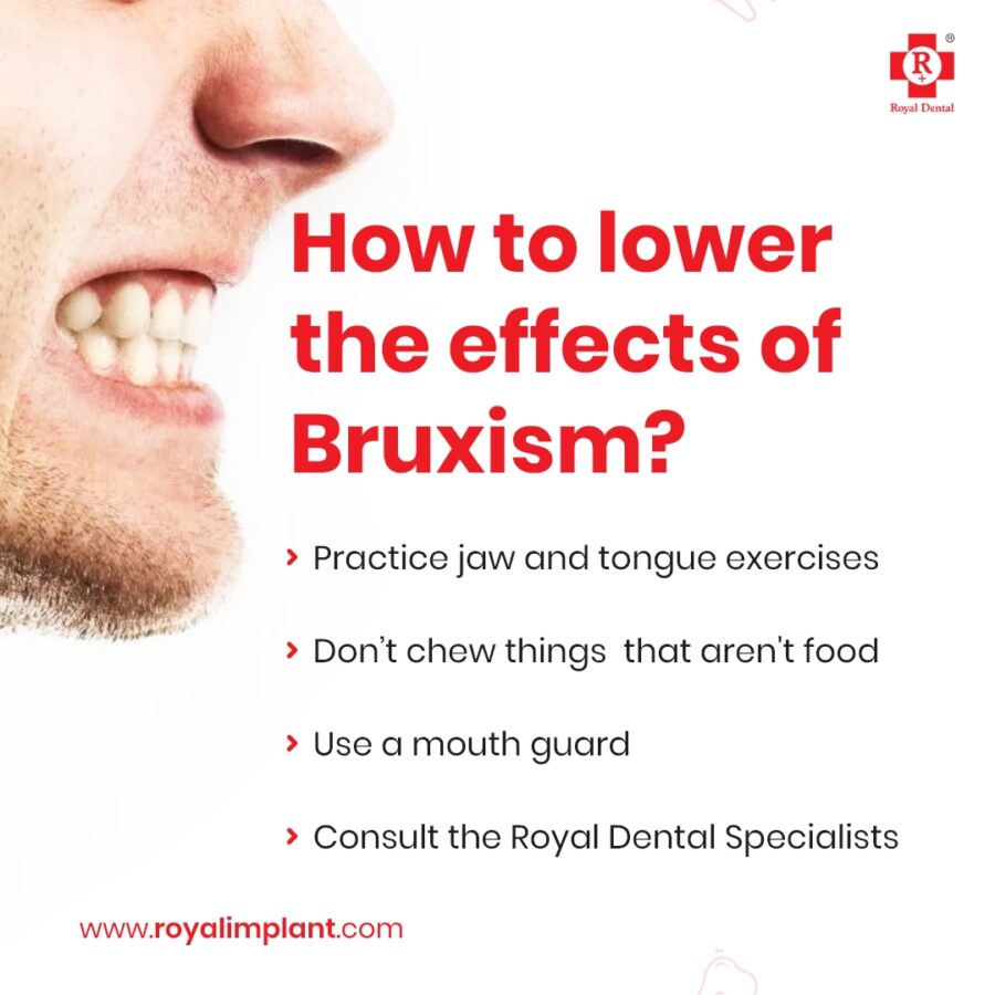 teeth grinding bruxism