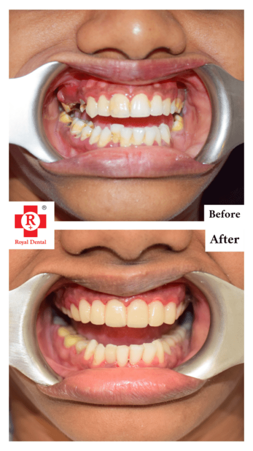Cosmetic Dentistry