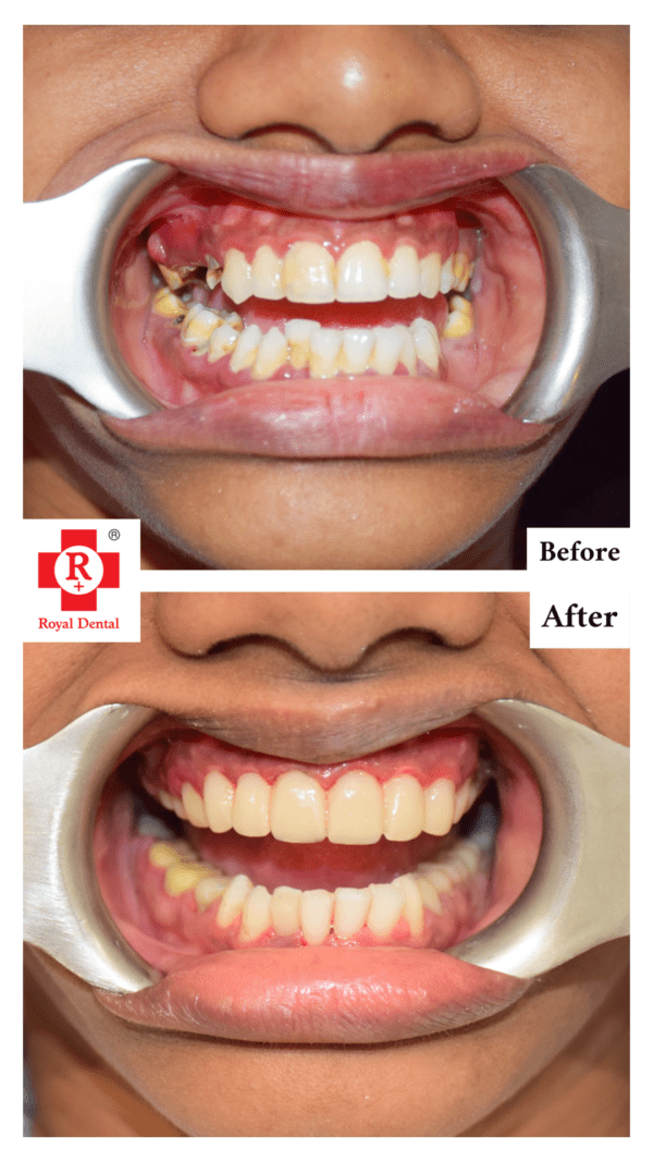 Cosmetic Dentistry