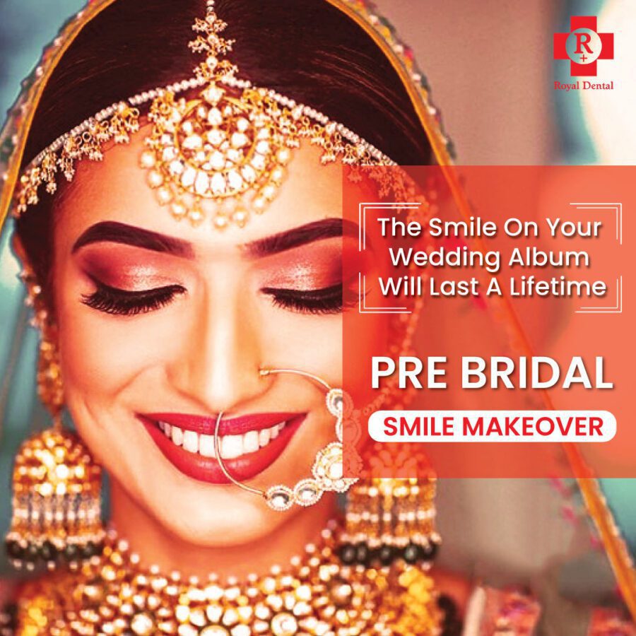 Perfect Teeth before Wedding