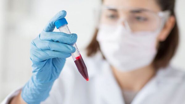 blood CBC test