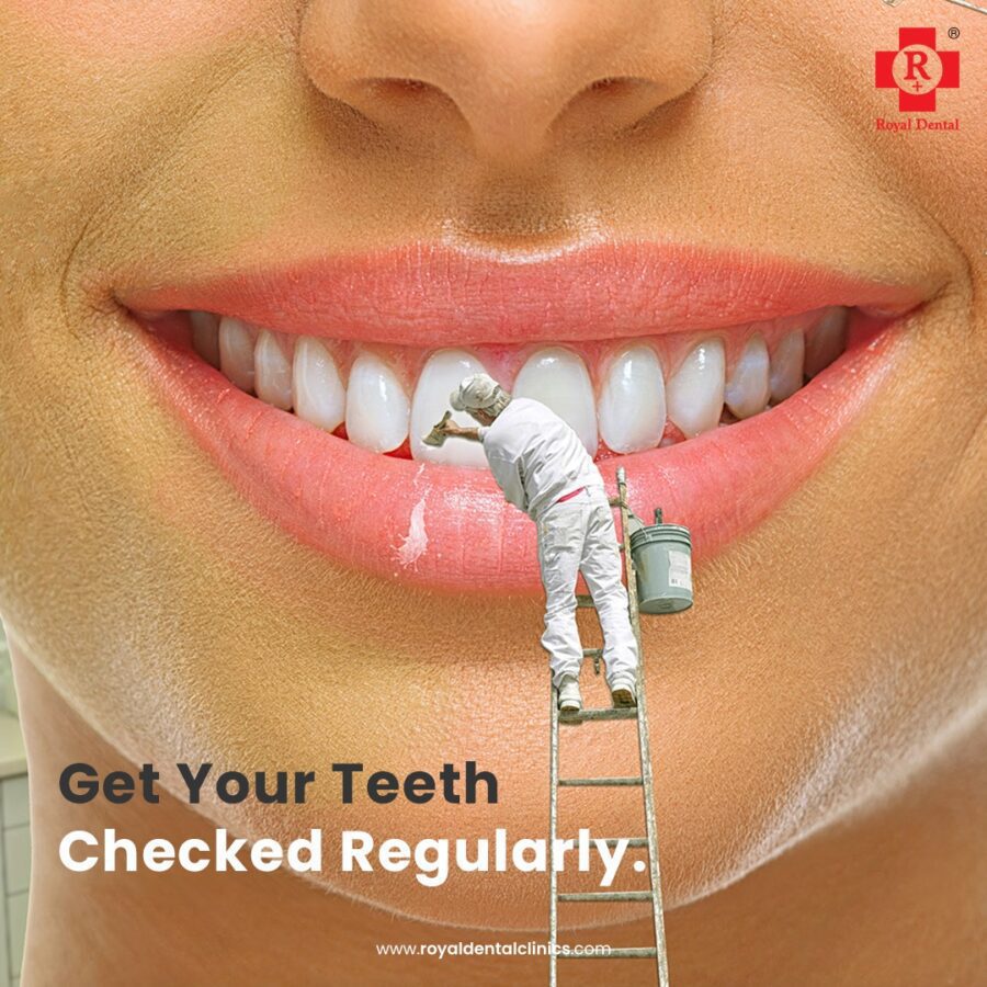 teeth cleaning