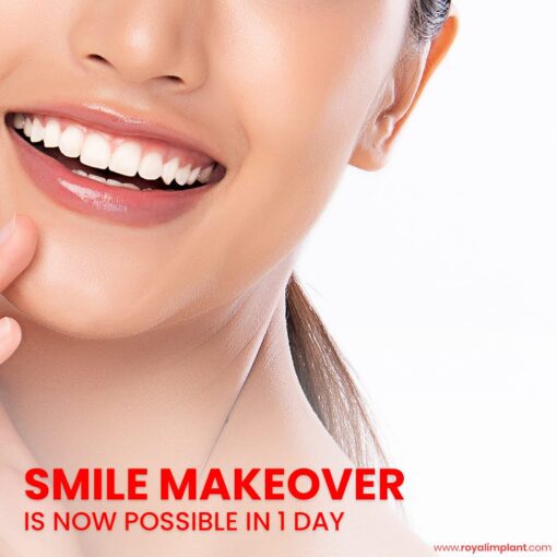 women-smiling-with-cosmetic-dentistry
