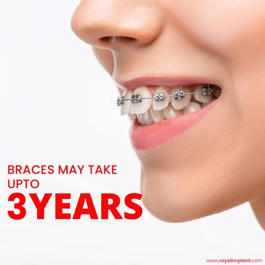 braces cosmetic dentistry
