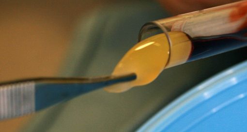 prp prf in dentistry