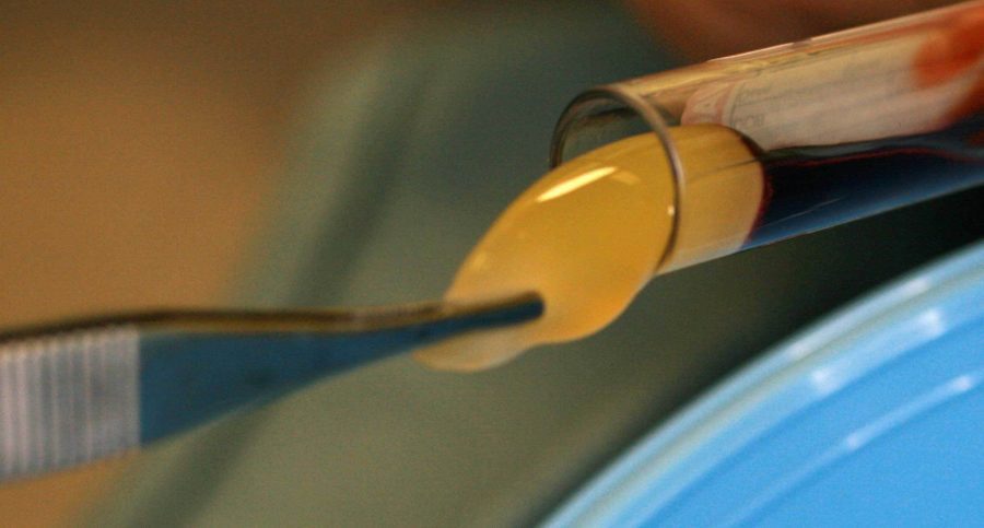 Platelet Rich Fibrin (PRF)