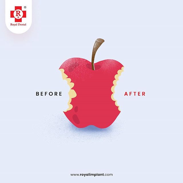 before after dental treatment