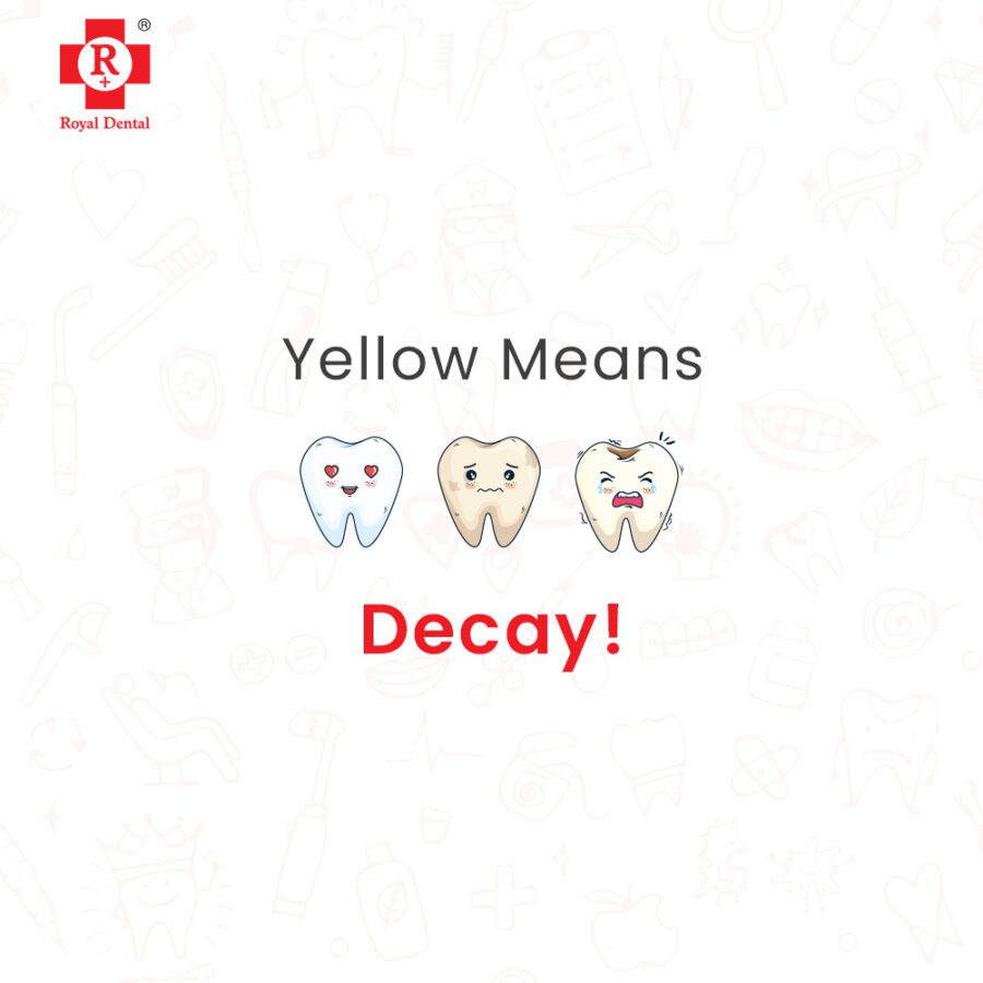 tooth decay dental treatment