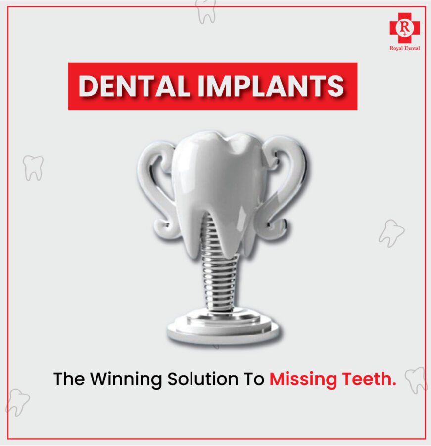 Failed Dental Implants