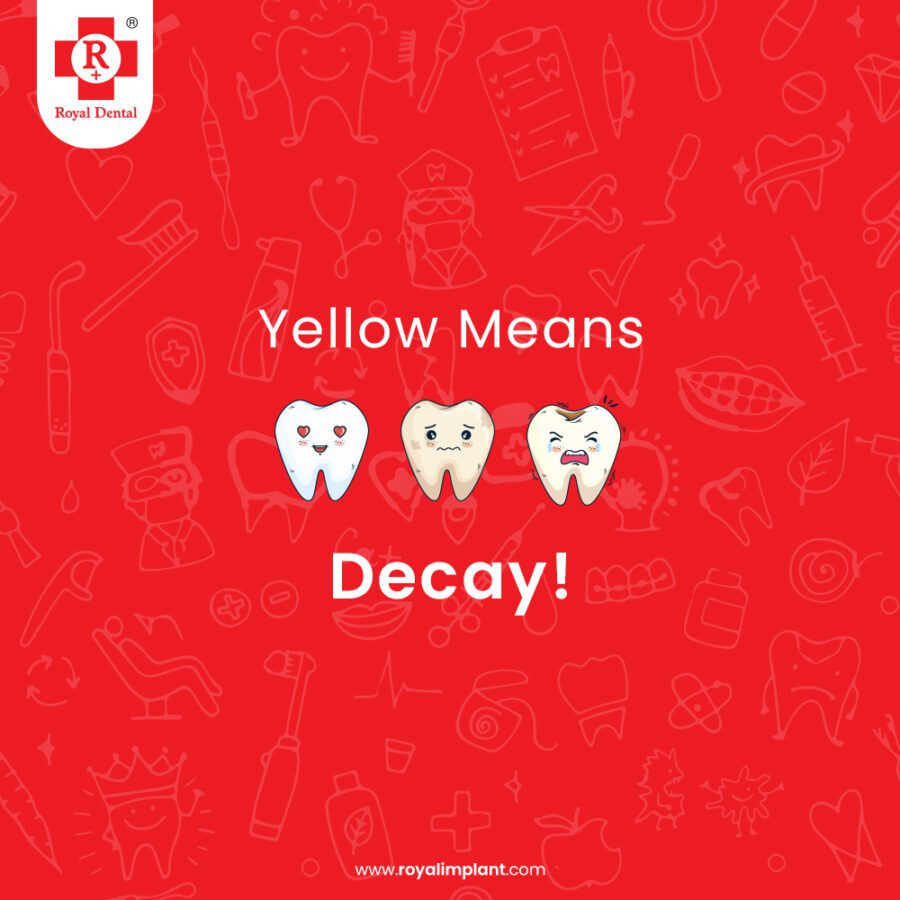 tooth decay treatment