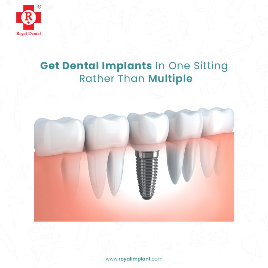 Failed dental implant failure