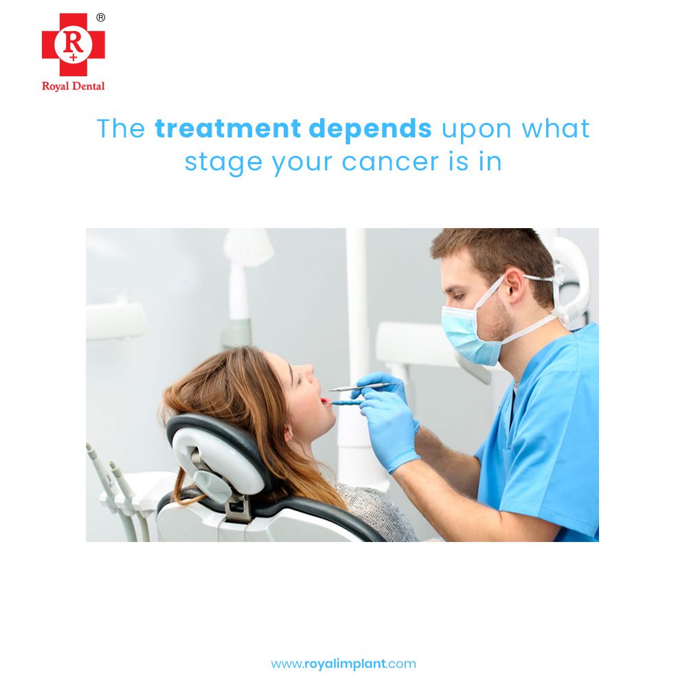 oral cancer
