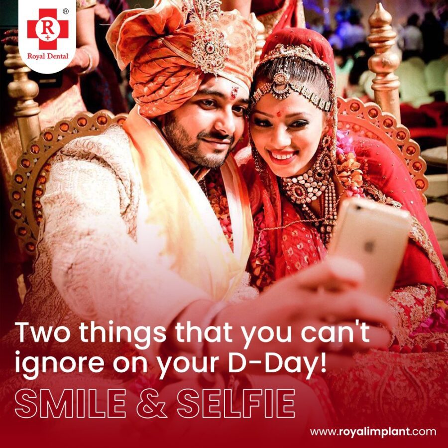  Wedding Teeth Beautification in One Day