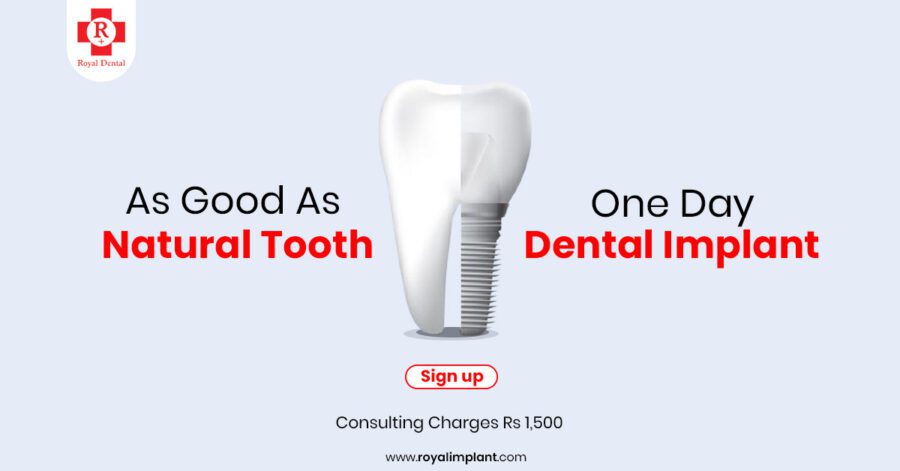dental implant in one day