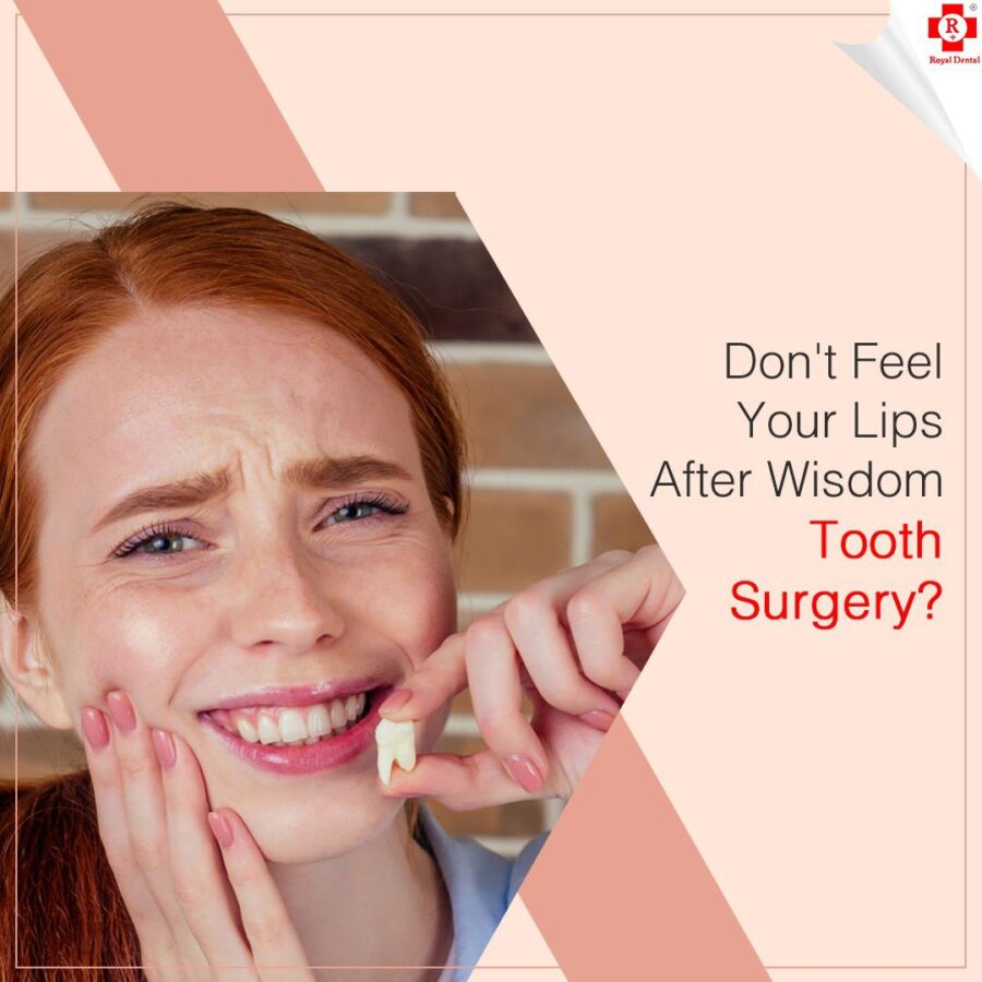 wisdom teeth removal