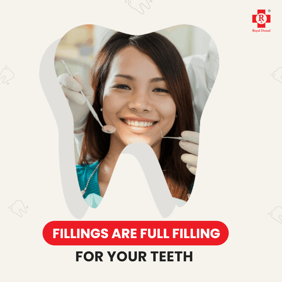 dental filling