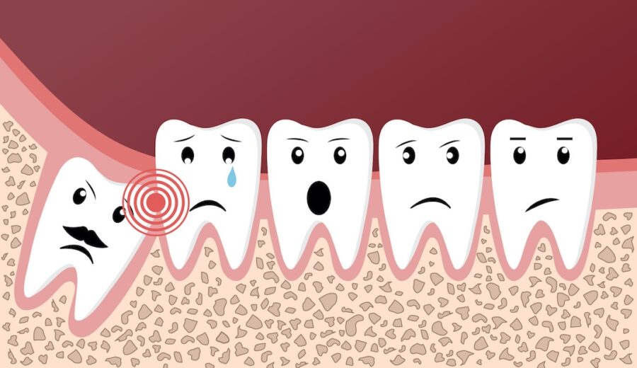 mobile teeth