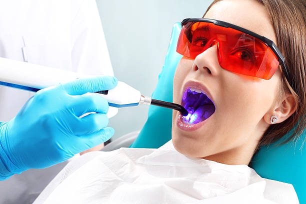 Root Canal Treatment Steps