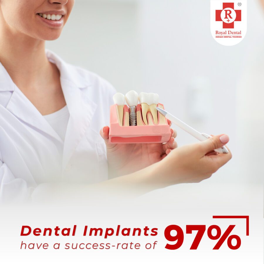 Dental Implant Success Rate