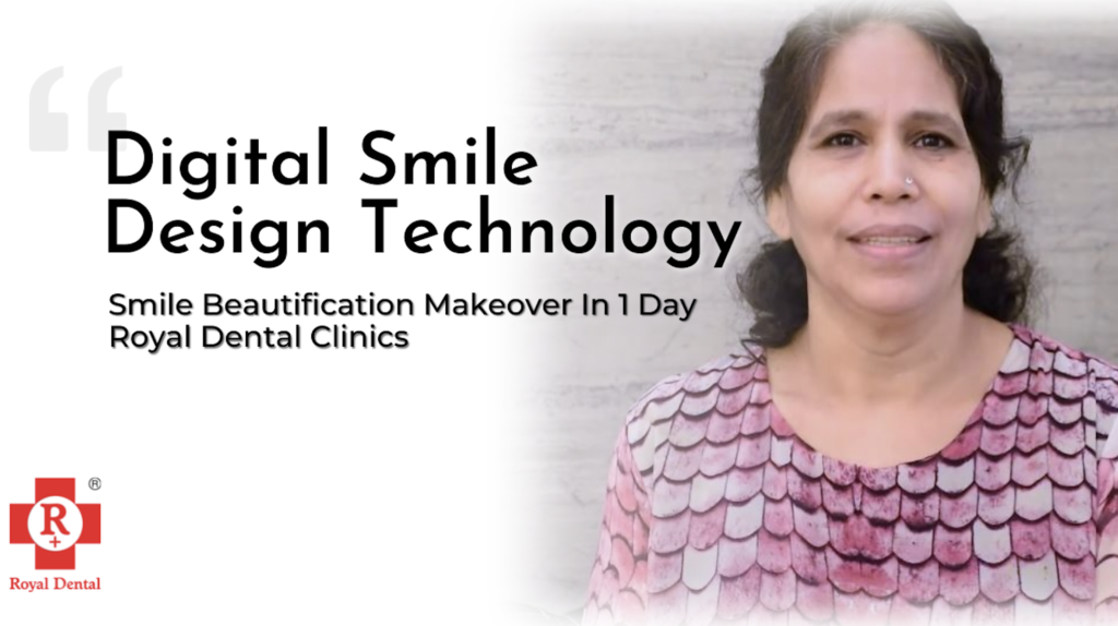 Digital Smile design technoloagy