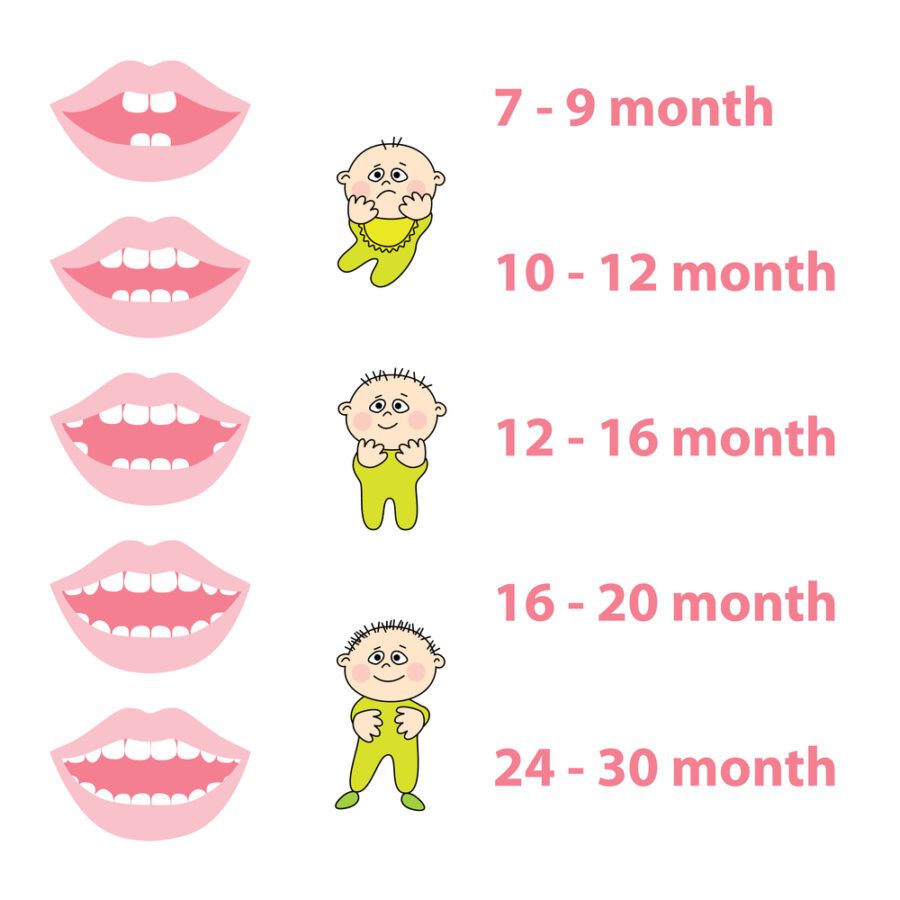 dental issues child