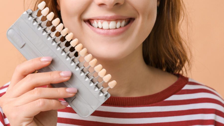Dental Veneers Cost in India