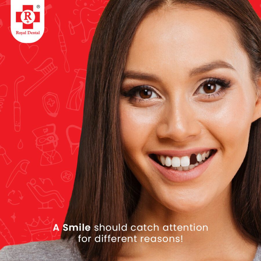 How to Save a Knocked Out Tooth: Emergency Dental Treatment Guide 2 missing teeth single - Save a Knocked Out Tooth