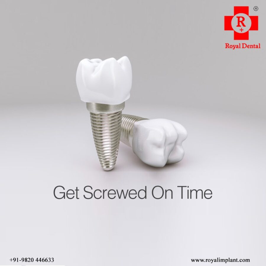 dental-implant-expenses