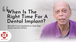Dental Implants In One Day