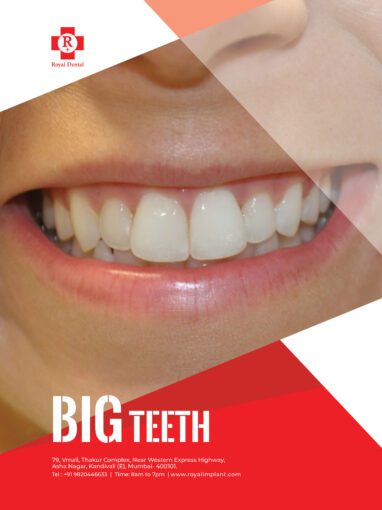 big teeth