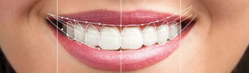 big teeth smile design