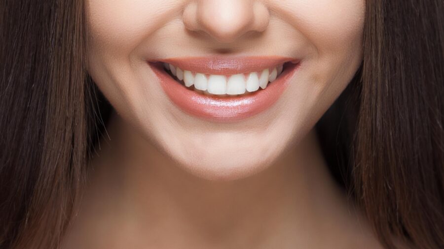 Smile beautification