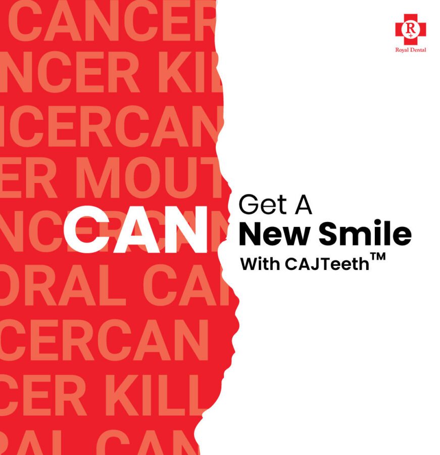 oral cancer rehabilitation CAJTeeth