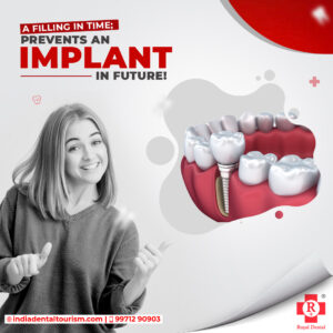 Filling-prevents-implant-in-future