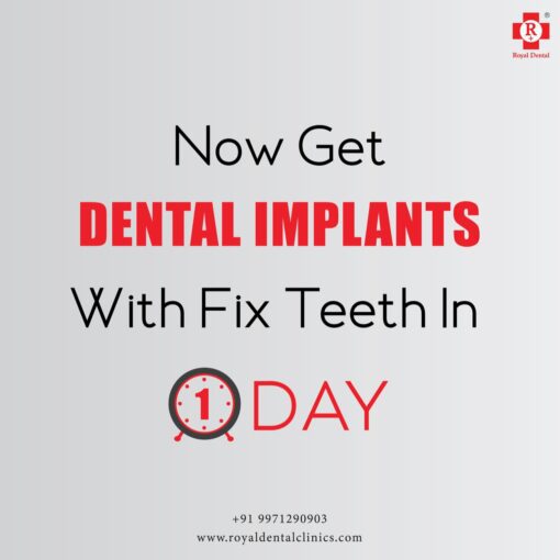 Fixed Teeth in One Day with Dental Implants