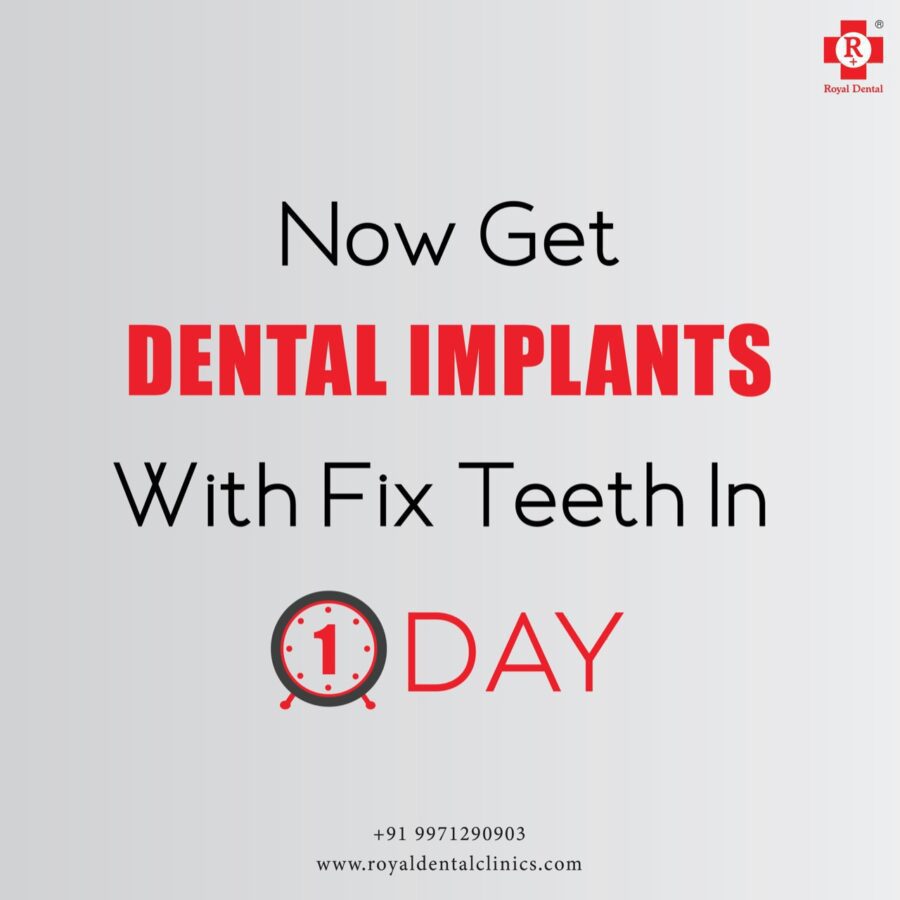 fixed teeth in one day