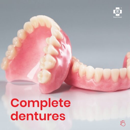 Dental Implants vs Dentures