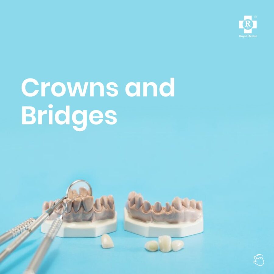 crowns and bridges