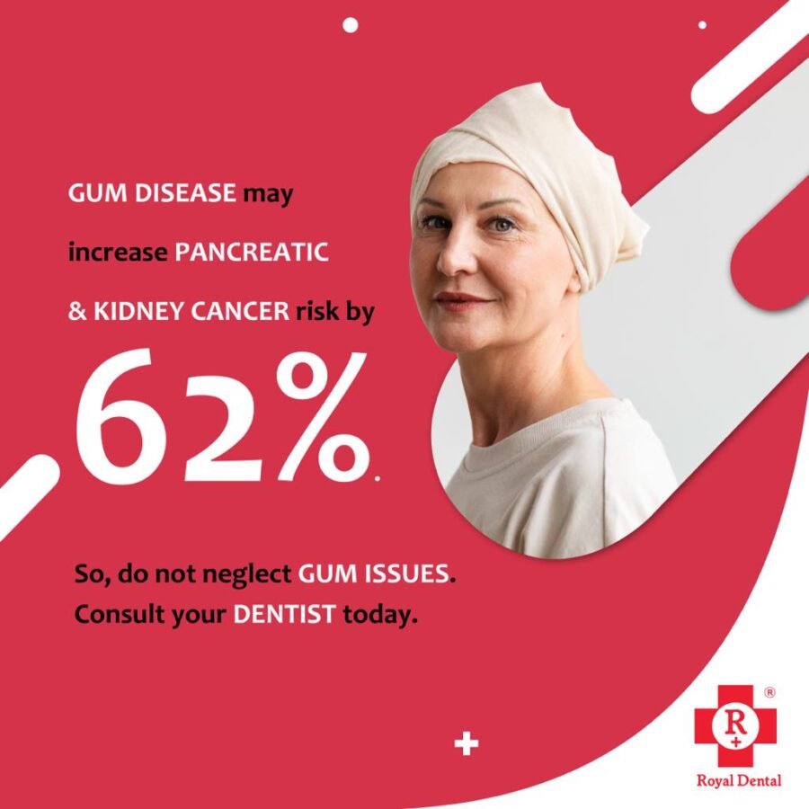 Oral Cancer