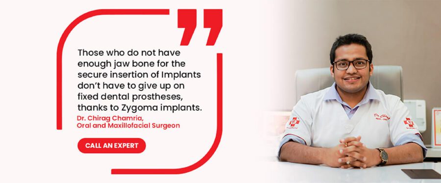 Zygomatic Implant Dentist