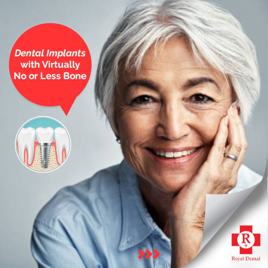 Zygomatic Implant process in One Day